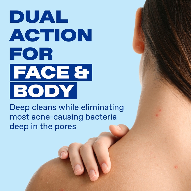 Cetaphil, Differin® пенка для очищения от акне, для лица и тела, 148 мл (5 жидк. унций)